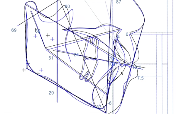 下げ幅の上限設計