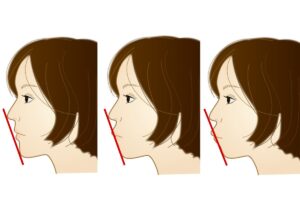 Eラインのイメージ